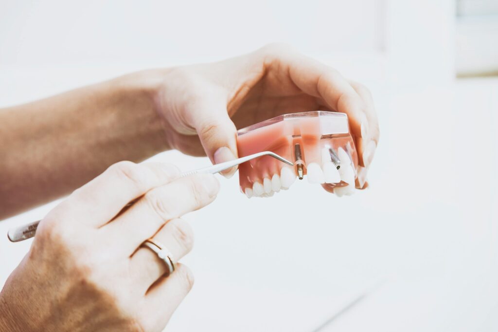 impianti-dentali